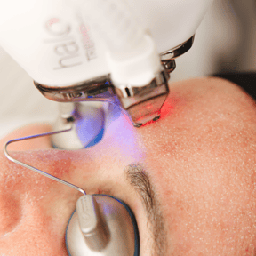 HALO® TRIBRID™ Laser