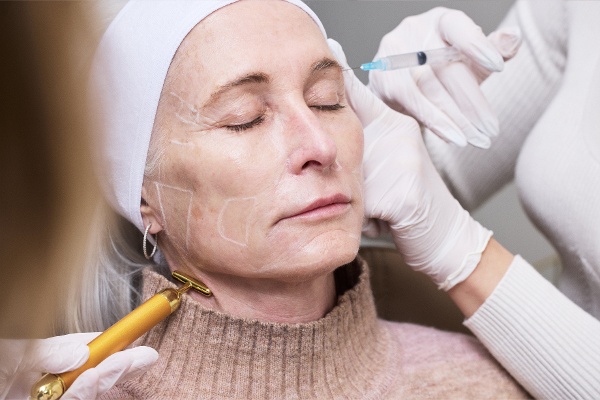 Sculptra Biostimulatory Filler Treatment-2